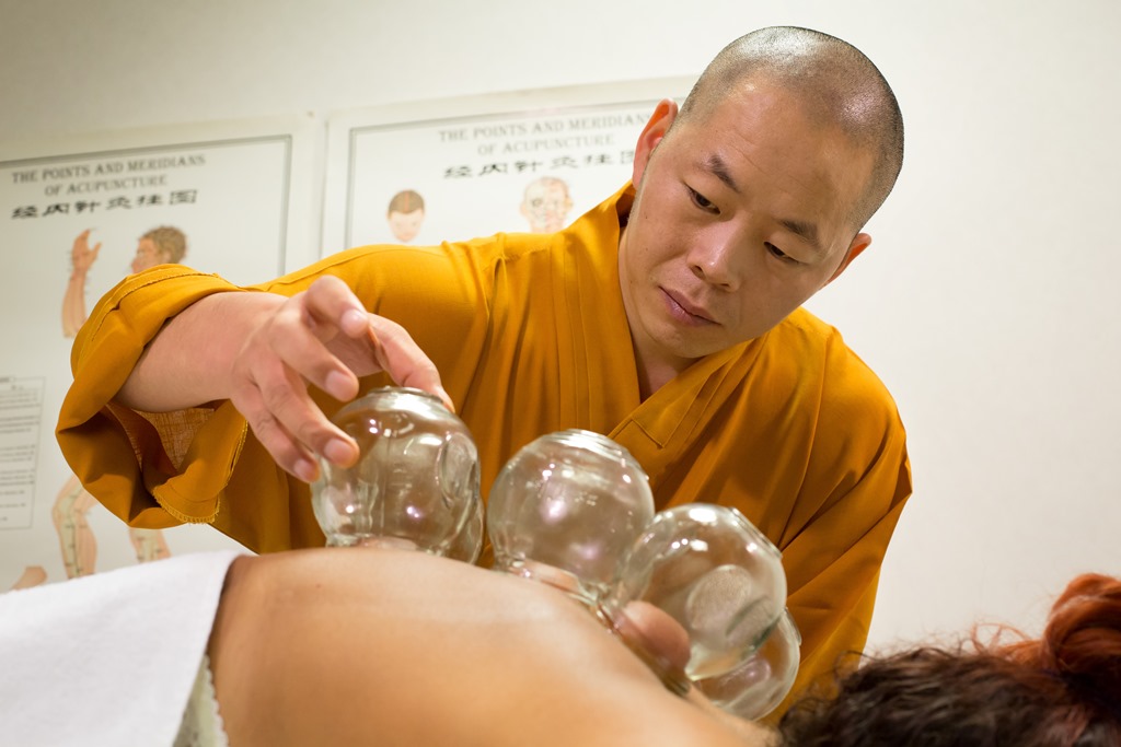 Trattamento di coppettazione presso il Centro Cultura Shaolin Italia