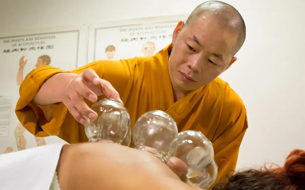 Maestro Shi Yan Hui durante un trattamento di coppettazione a Roma